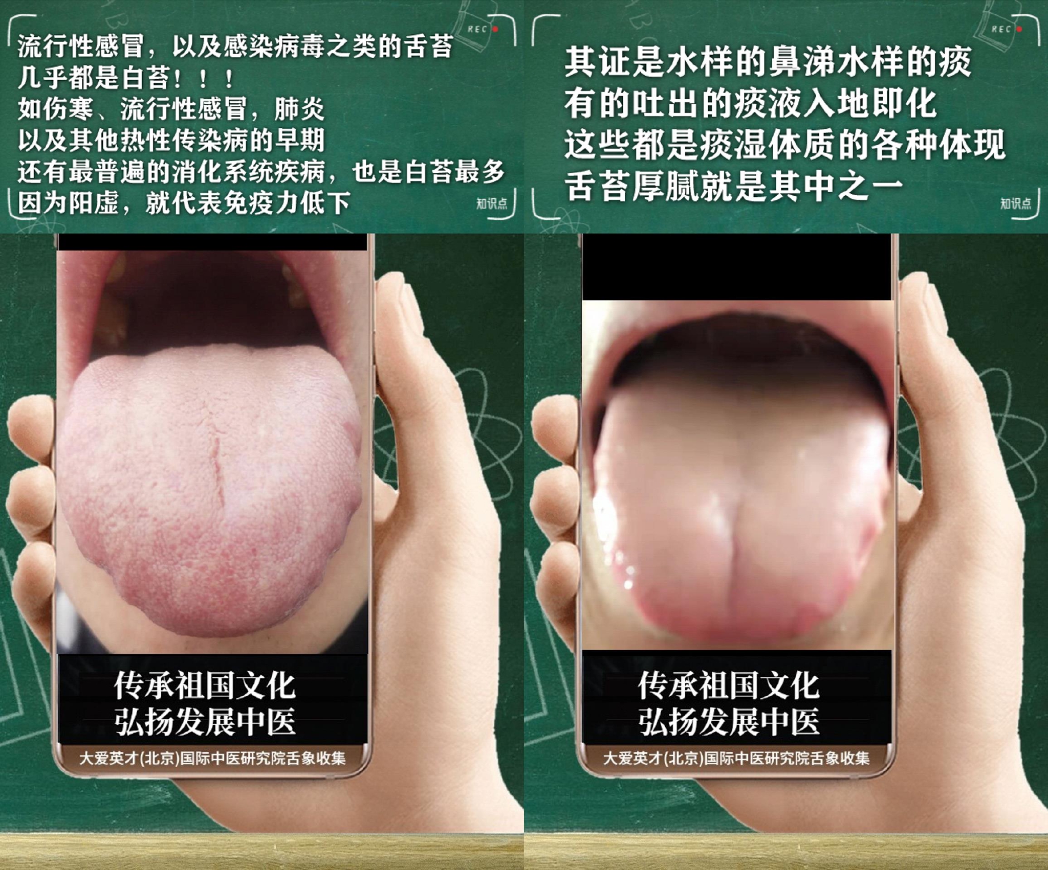 中医解析长期焦虑提不起干劲吐白痰气滞不降