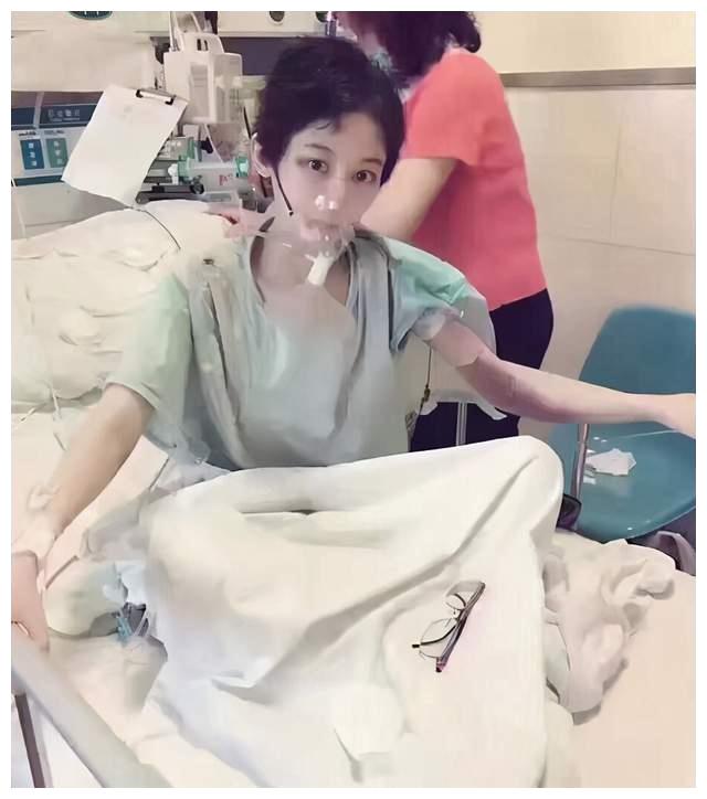 4年前26岁的徐婷全身溃烂离世其实背后藏着秘密