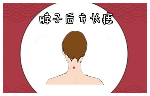 脖子后方长痣一个人的脖子的后方长有吉痣,会被称之为靠山痣,大多数的