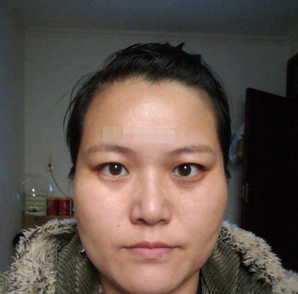 从面相中看子女宫暗淡,眼袋浮肿,这些都作息不合理导致的,晚上早点