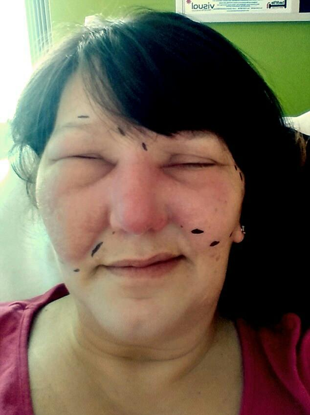 怕被传染|鼻子|疾病|蜂窝_新浪新闻