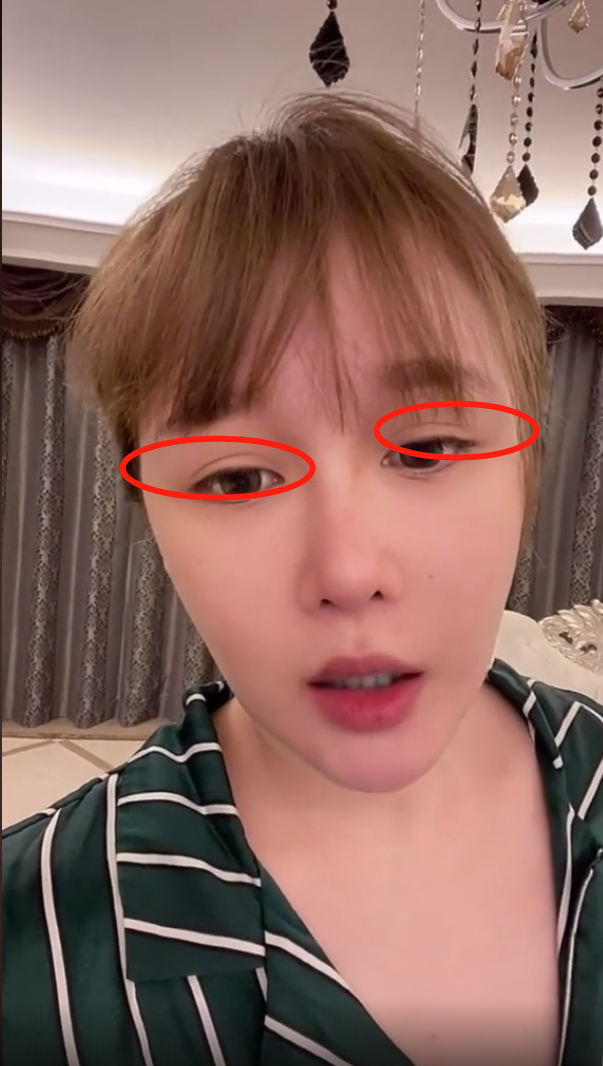 赵本山女儿球球对手机卖萌,头发金黄脸部浮肿,双眼皮痕迹明显