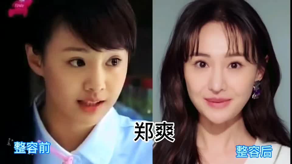 10位女明星整容前后对比鞠婧祎整容走向巅峰邵音音整成丑八怪