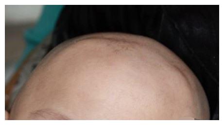 宝宝这三个部位长得丑暗示有福气父母可别嫌弃