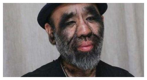 当初轰动全国为之侧目的"毛孩",43年匆匆而过,如今生活怎样?