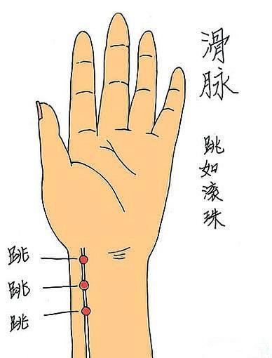 古代中医是如何摸出"喜脉"的?方法很简单,一看就会