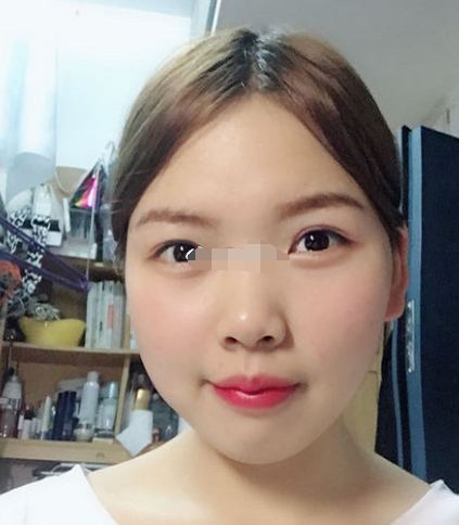 山根低,做事缺乏自信,容易被他人的意志所左右