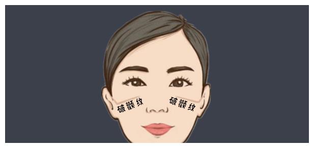 颧骨有破纹,仕途不到头;鼻梁有削骨,欺负老实人