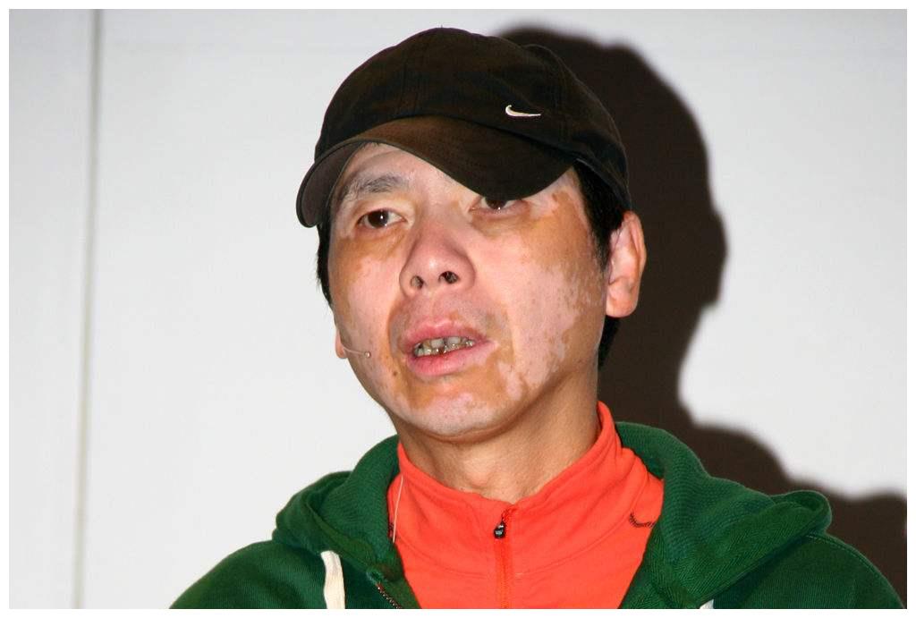 62岁冯小刚近照患白癜风多年斑秃明显皮肤比女明星还白