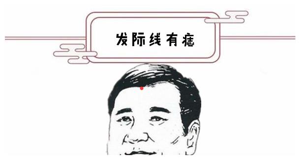 发际线有痣发际线有痣并且还是吉痣的话,能够看出这种人在事业上都会