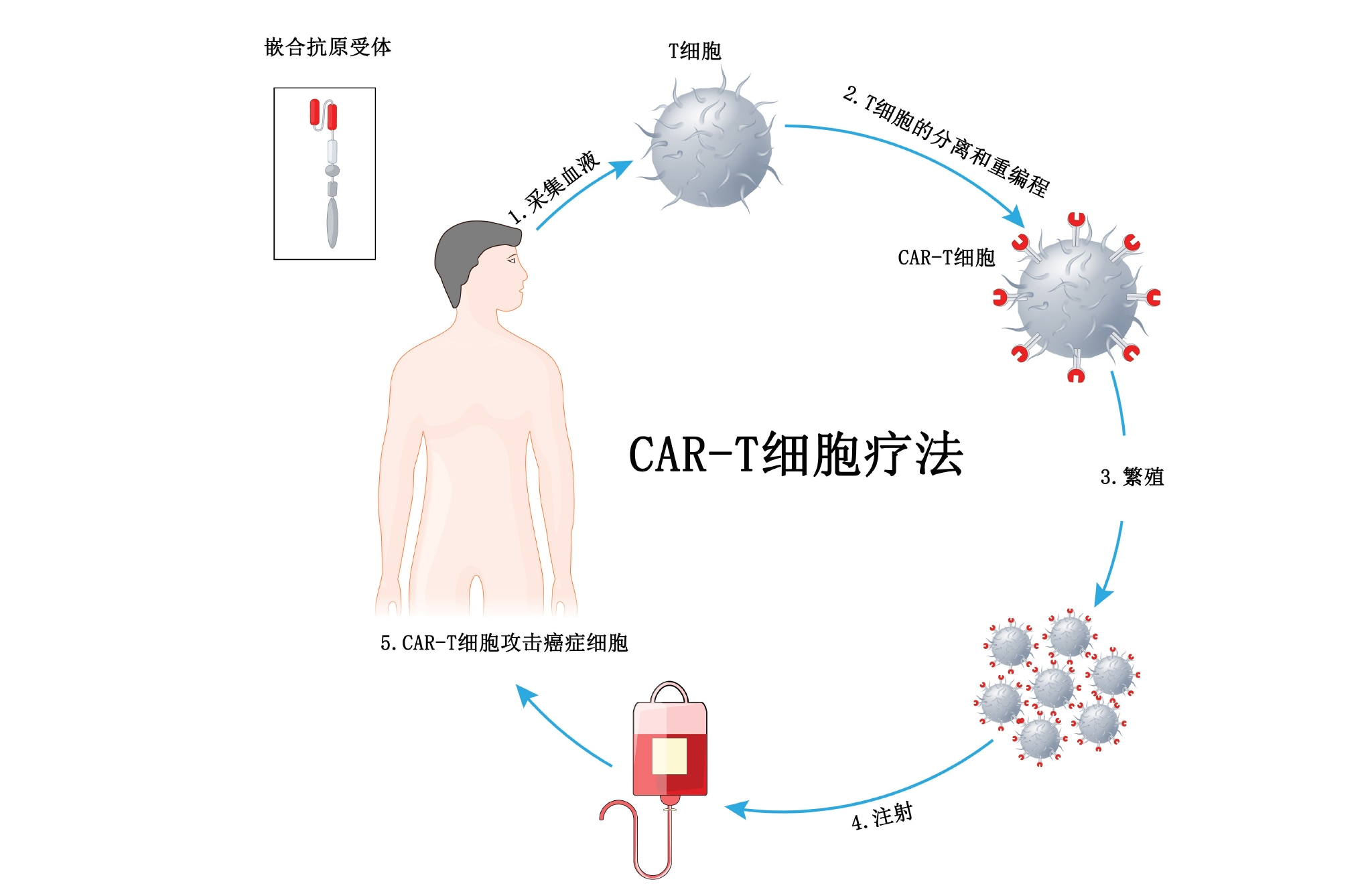 复发难治性滤泡型淋巴瘤cart细胞疗法kymriah获fda加速批准