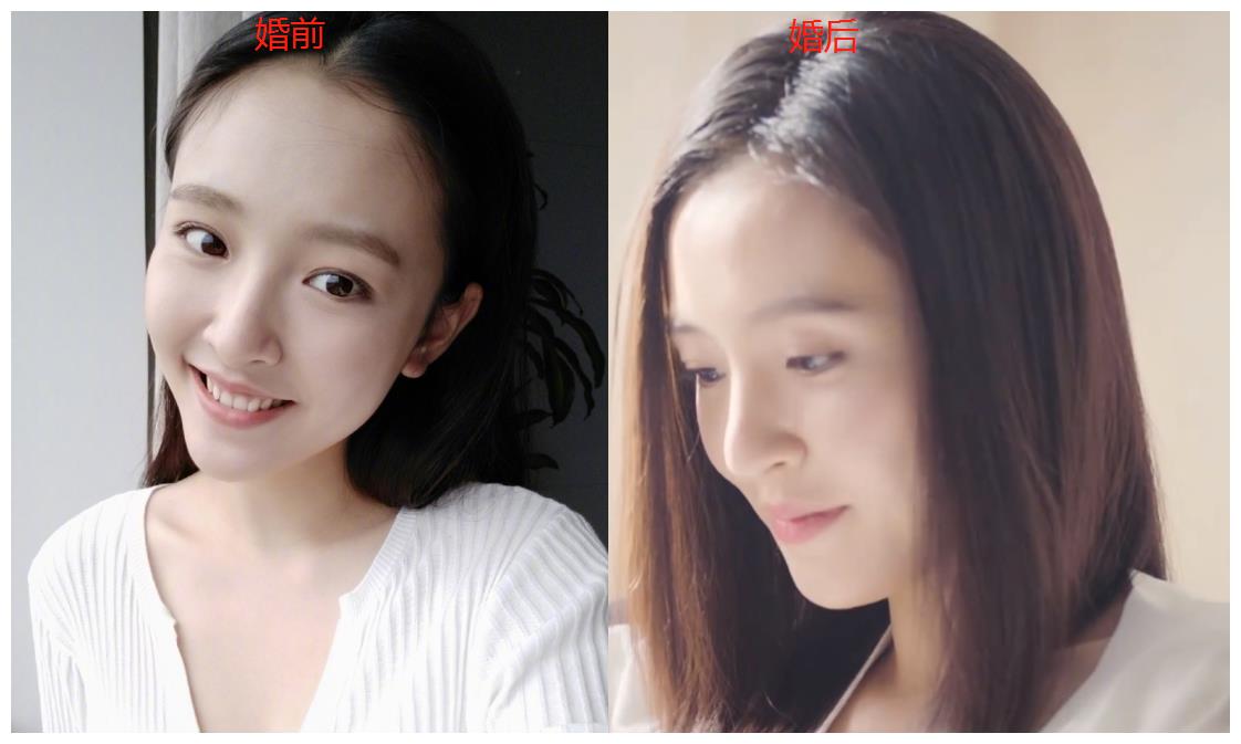 吴倩当妈后颜值如何?产后直播生图被扒,婚前婚后的差距好明显