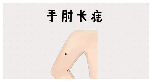 身体4颗"财富"痣,每颗都带着钱,你一定有一颗