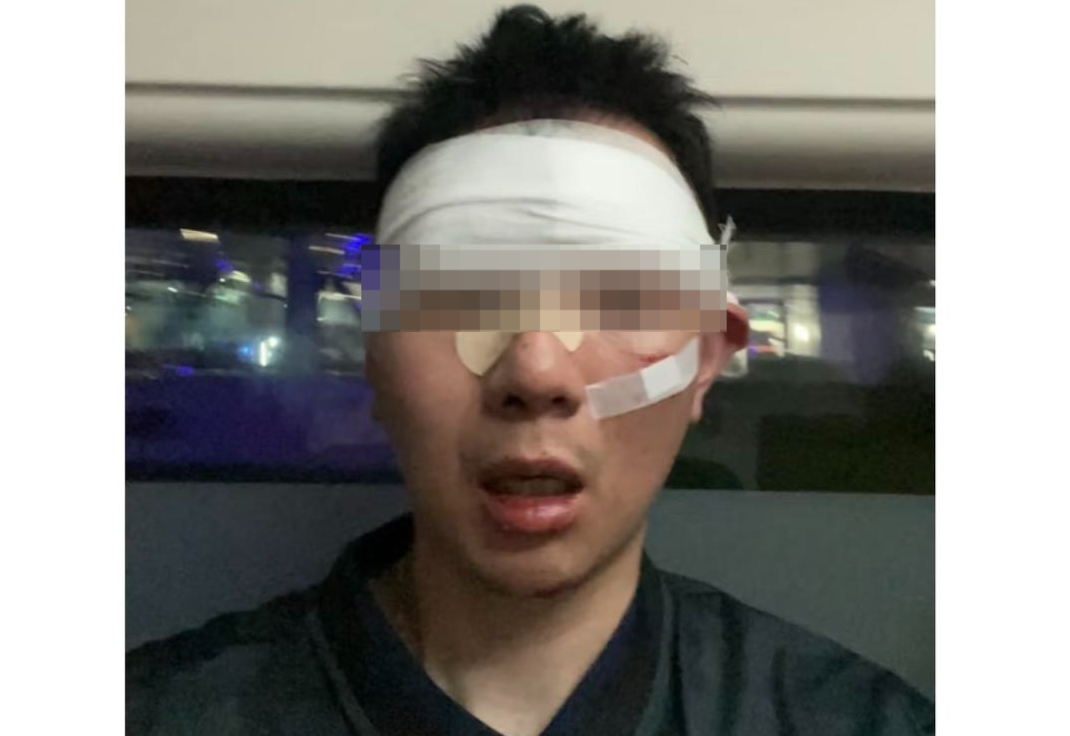 男子看蔡依林演唱会,额头撕裂缝30多针!多名观众受伤主办方道歉 男子看蔡依林演唱会,额头撕裂缝30多针!多名观众受伤主办方道歉