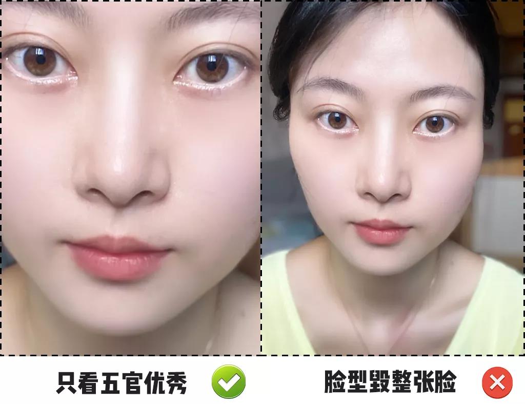 单侧咀嚼变大小脸?其实不止这么简单
