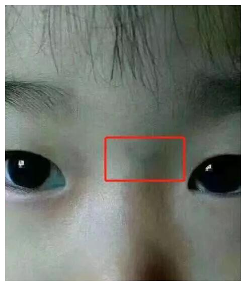 积食不是脾胃太娇气有2个原因常被父母忽略需重视