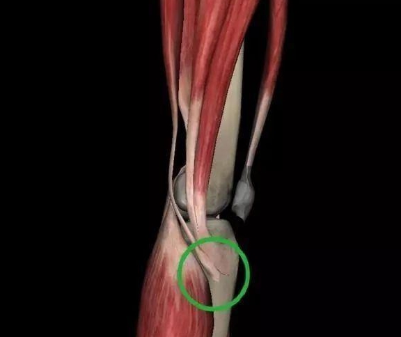 分为膝关节前侧的上方和下方疼痛,上方疼痛应该考虑股四头肌在髌骨的