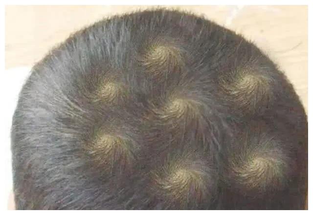 孩子头顶"旋"多,这代表什么意思?我们抛开迷信来看看科学依据