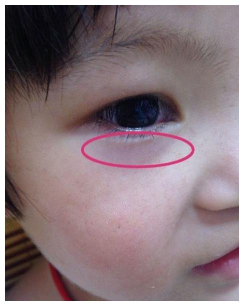 秋季带娃3种水果孩子馋也别给娃吃脾虚易积食