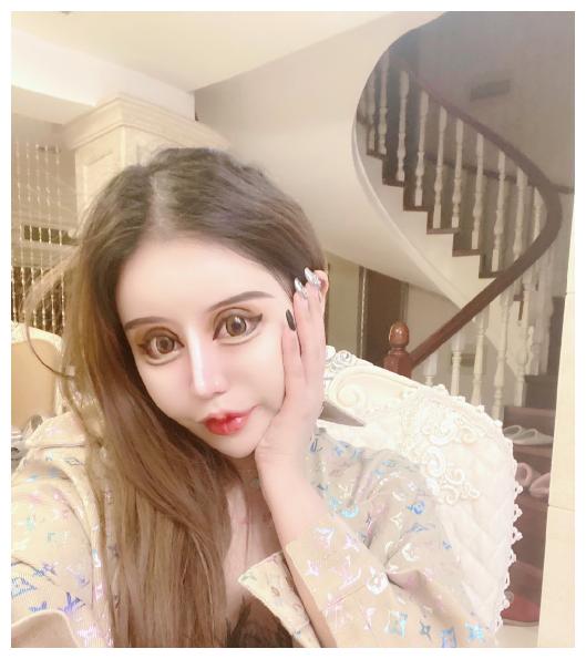 "女网红"13岁开始整容,整容60次花掉100万,如今却一言难尽