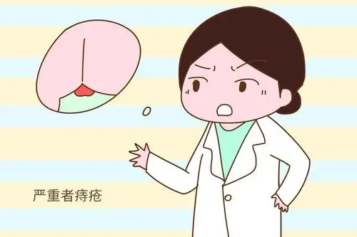 痔疮|肛门|女性_新浪新闻