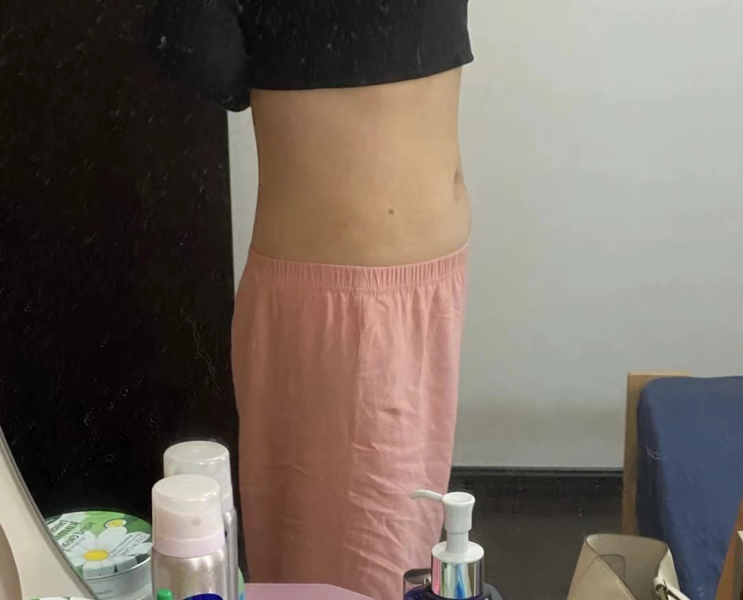 澳门女子突然肥胖 不是怀孕、减肥不见效是体内长了21斤重的肿瘤休闲区蓝鸢梦想 - Www.slyday.coM