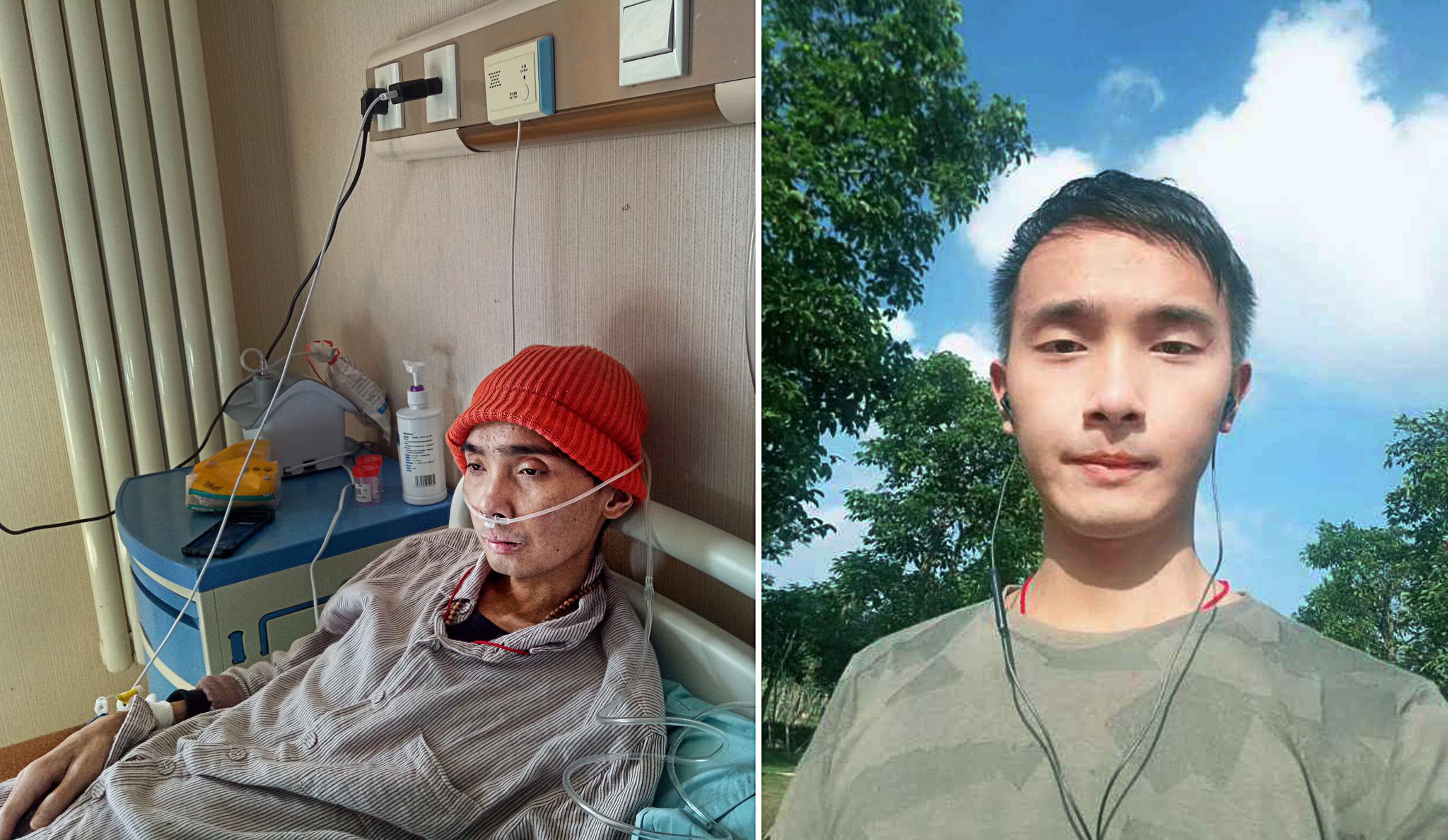 患病前后的周平