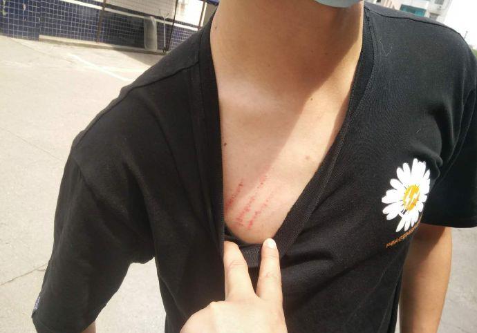 绵阳一小伙不忍长期被妻子家暴,便选择离婚,离婚后仍被"家暴"