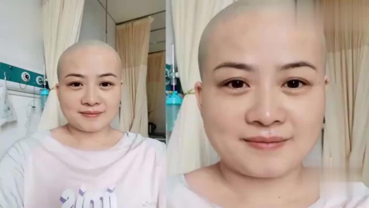 video播放 00:00 01:02 01:02 为您推荐: 岳云鹏妻子半年内两次剃光头