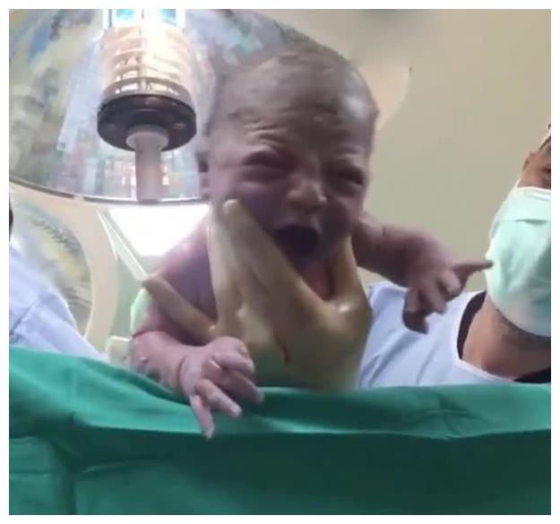 白皮夫妇生下"非洲"宝宝,全家都很疑惑,可60天后出现"逆袭"