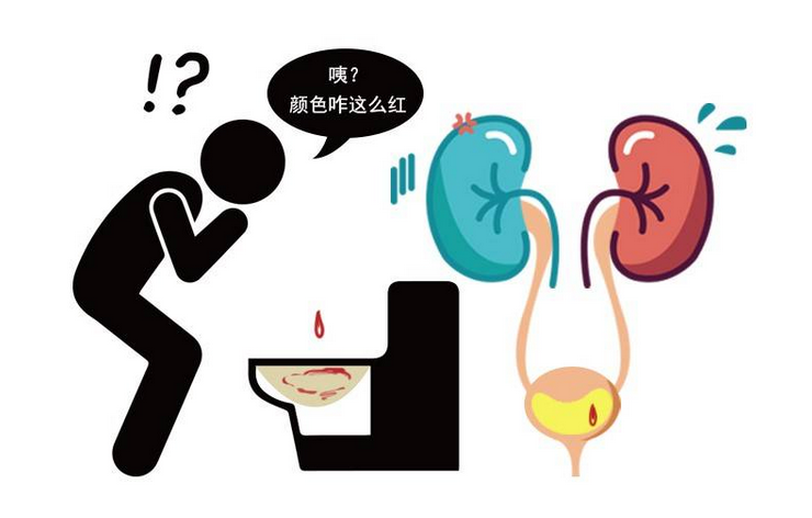 男人肾脏出问题，身体4个症状或提示你，发现后别视而不见休闲区蓝鸢梦想 - Www.slyday.coM