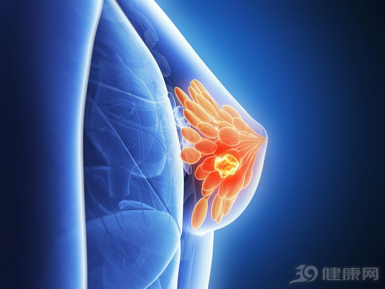乳腺癌的15个征兆图片图片