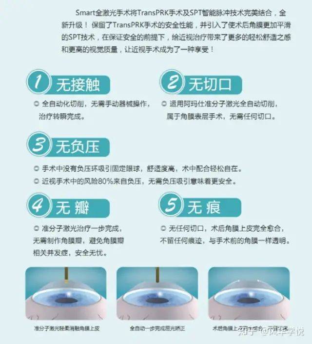 眼科设备销售怎么样郑州卓美眼科：解析阿玛仕1050Rs设备Smart全激光_https://www.jmylbn.com_新闻资讯_第7张