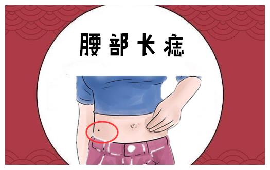 腰部长痣在相学当中,若是在腰部的位置处长有吉痣,则会有"腰缠万贯"的