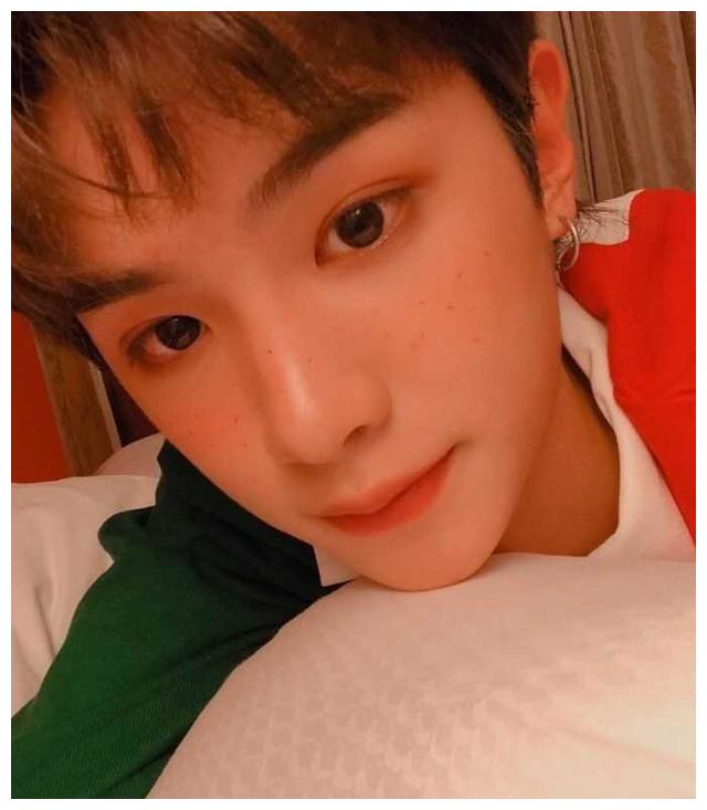 脸小遮百丑,而脸肿会怎么样看看justin就知道