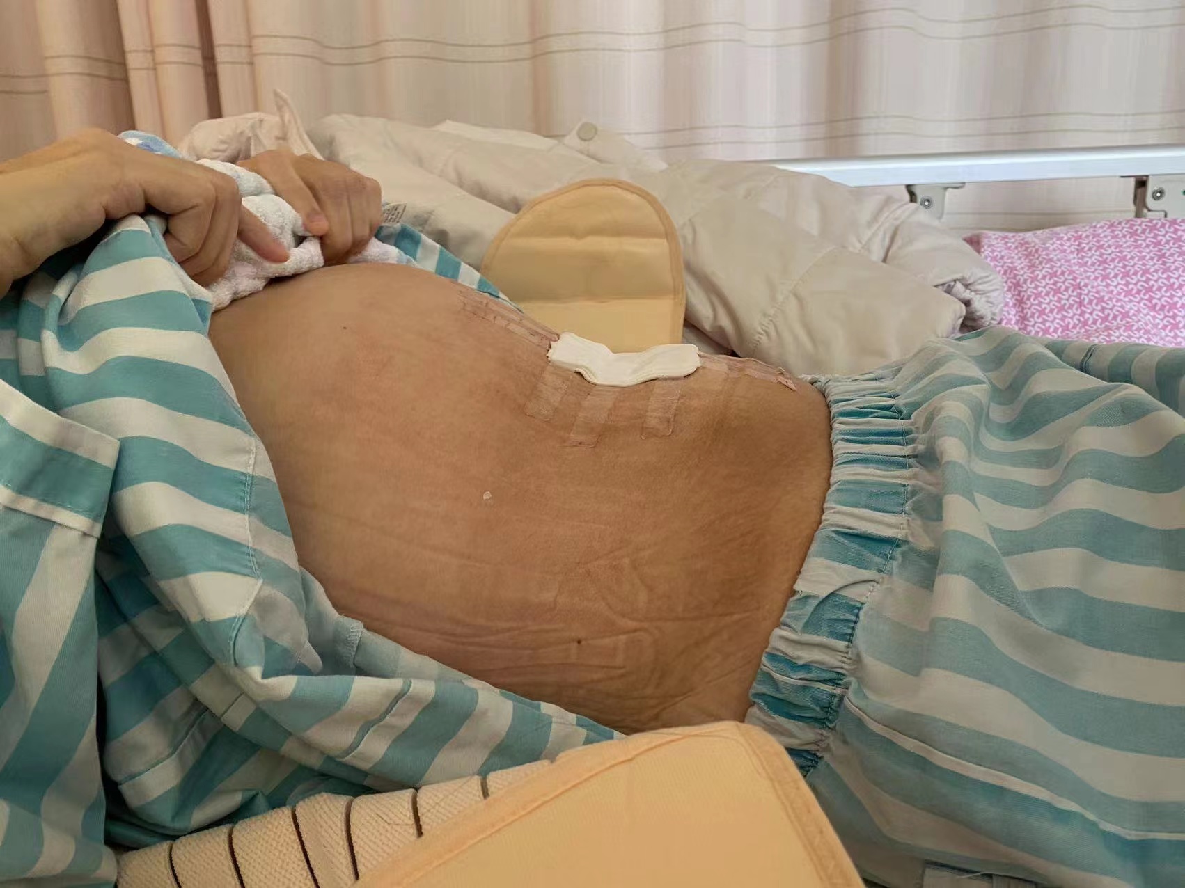 澳门女子突然肥胖 不是怀孕、减肥不见效是体内长了21斤重的肿瘤休闲区蓝鸢梦想 - Www.slyday.coM