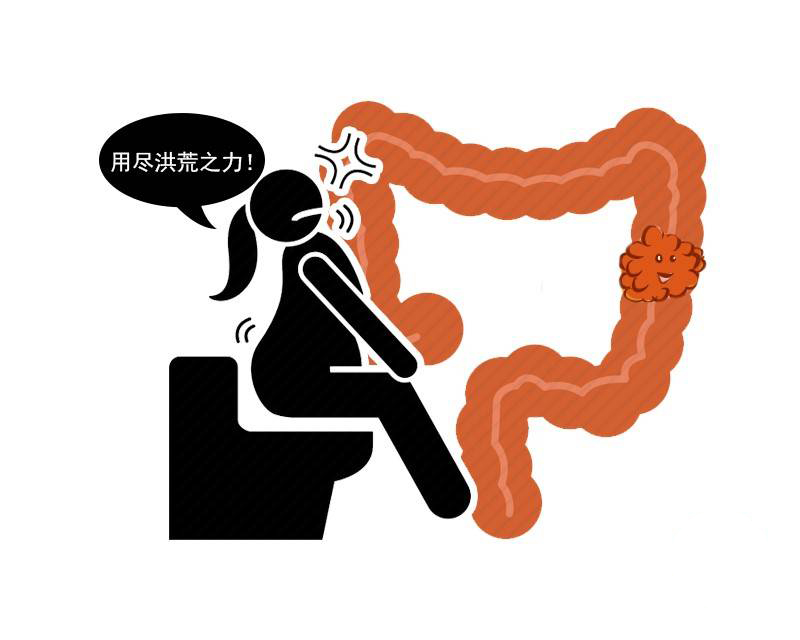 中国便秘日:5000万人总是拉不出屎?做好3件事,远离便秘的烦恼休闲区蓝鸢梦想 - Www.slyday.coM 中国便秘日:5000万人总是拉不出屎?做好3件事,远离便秘的烦恼休闲区蓝鸢梦想 - Www.slyday.coM