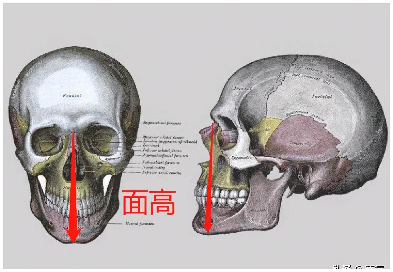 到下巴软组织的最低点,具体是指软组织鼻根点至软组织颏下点的距离,就