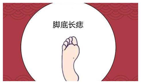 身体5颗财禄痣有贵人靠万贯家财福泽子子辈辈