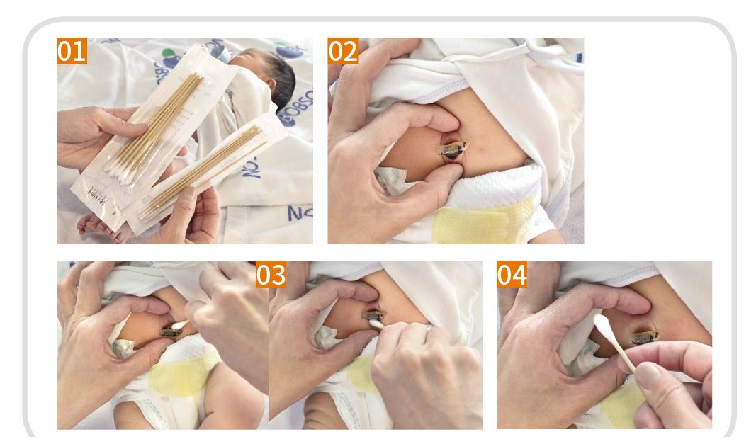勤换尿布避免尿红臀,脐带护理养出漂亮肚脐眼 新生儿护理全教学