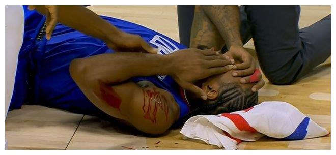 伊巴卡铁肘六亲不认!伦纳德遭肘击血溅赛场 两年前的仇成功得报