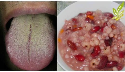 舌苔又白又厚是疾病吗