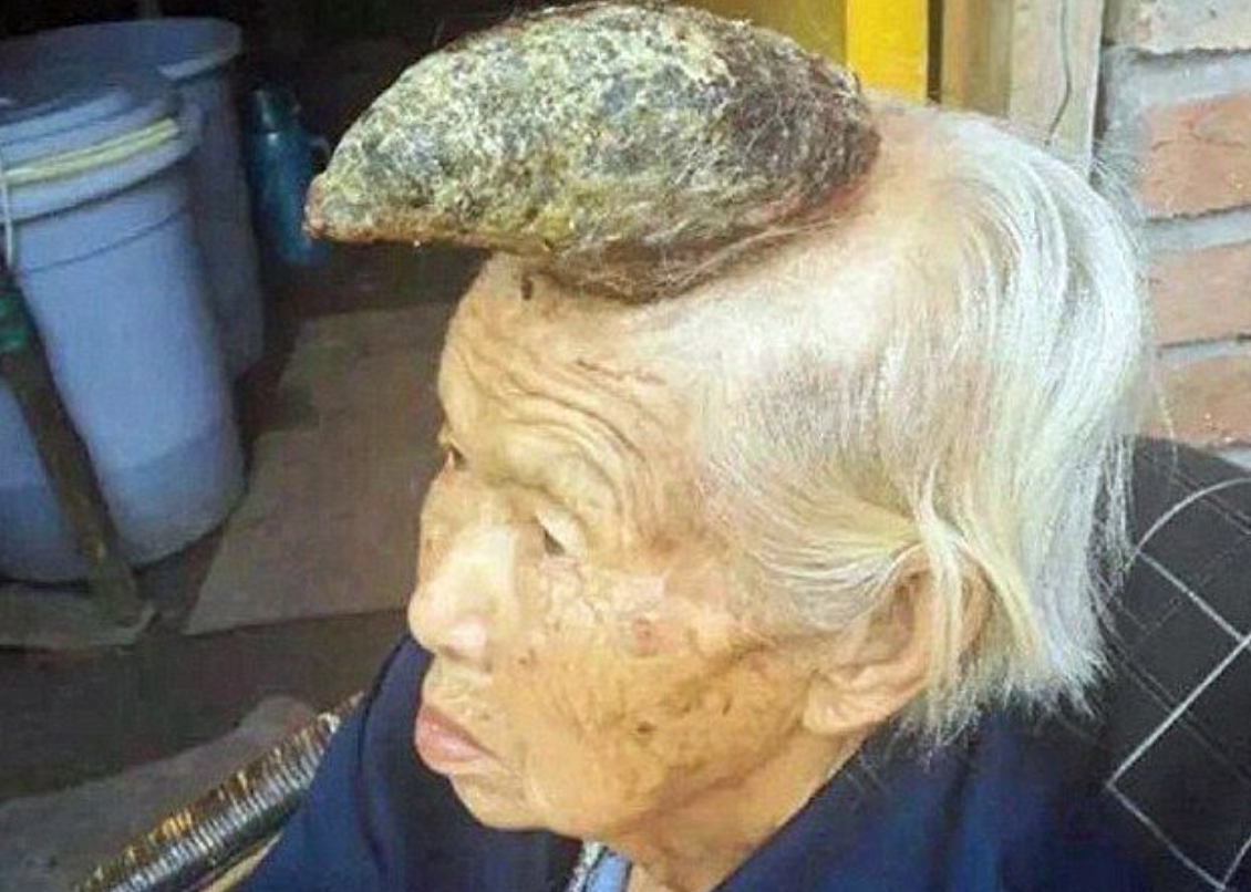 老人百岁额头长角,面对儿女劝阻,她说出了一个秘密