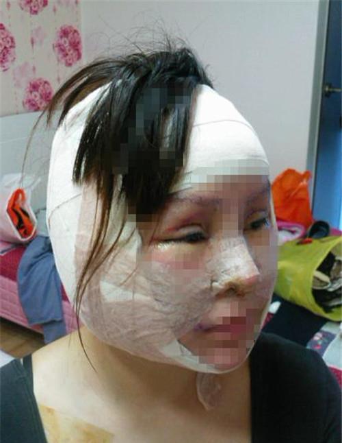 经常性也会看到一些因为去了不正规的美容院而导致整容失败感染的案例