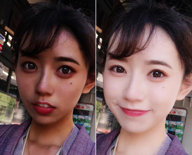 晒黑之后多久能恢复?怎么快速变白回来?