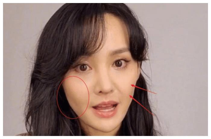 郑爽状态再次上热搜,脸颊凹陷特显老,网友:整容后遗症?