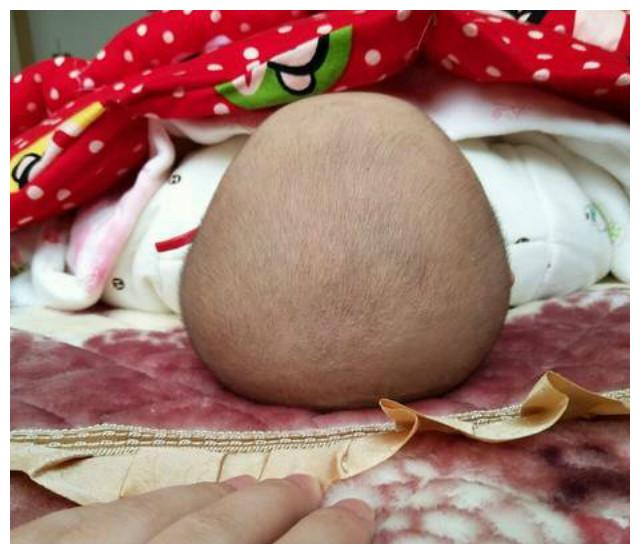 3种睡姿影响孩子头型大脑发育受限聪明妈妈别让宝宝这样睡了