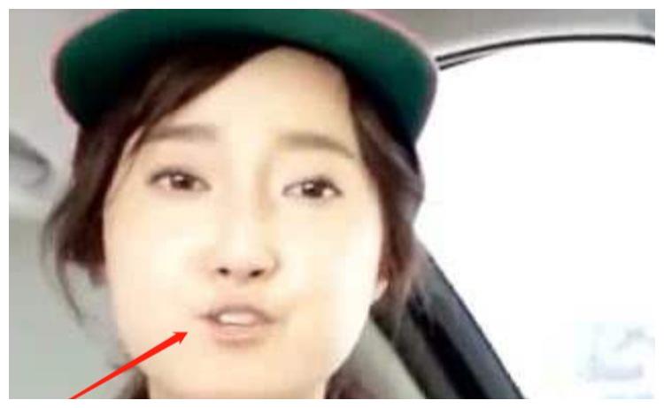 世界上嘴巴最小的女人只有3厘米还没有硬币大姚晨知道乐了