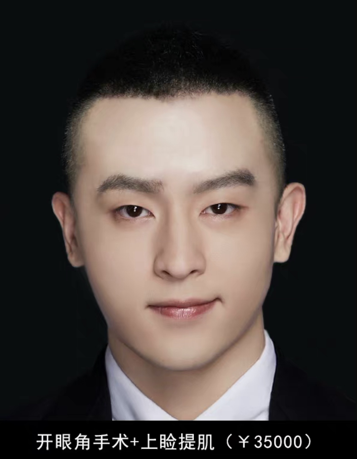 岳云鹏整形后是邓伦普通人靠它竟能秒变帅哥