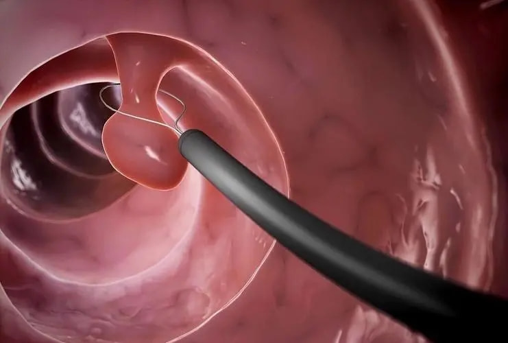 检查身体必须做的项目有哪些?看完你就有数了休闲区蓝鸢梦想 - Www.slyday.coM 检查身体必须做的项目有哪些?看完你就有数了休闲区蓝鸢梦想 - Www.slyday.coM